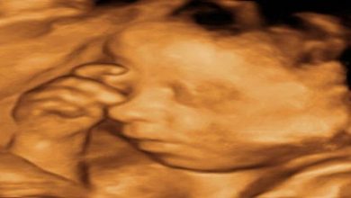 Detaylı Fetal Ultrasonografi (İkinci Trimester Ultrasonografisi)