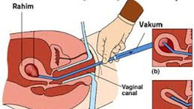 Kadın Doğum Hakkında Bilinmesi Gerekenler – Soru Cevap