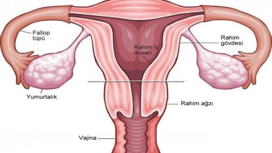 Kadın Genital Sistem Enfeksiyonları ve Cinsel Yolla Bulaşan Hastalıklar