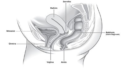 Kadınlarda Pelvik Organ Sarkması