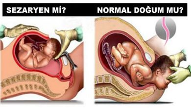 Normal Doğum mu, Sezaryen mi?