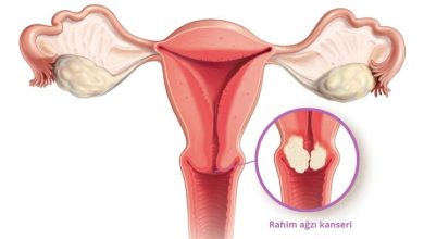 Rahim Ağzı (Serviks) Kanserinden Korunma Yolları Nelerdir?