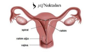 RAHİM İÇİ ARAÇ ( RIA , SPİRAL)